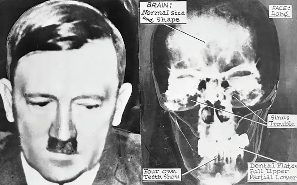 Kiedy zmarł Hitler? Zaskakujące okoliczności jego śmierci