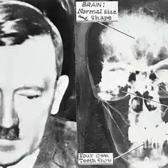 Kiedy zmarł Hitler? Zaskakujące okoliczności jego śmierci